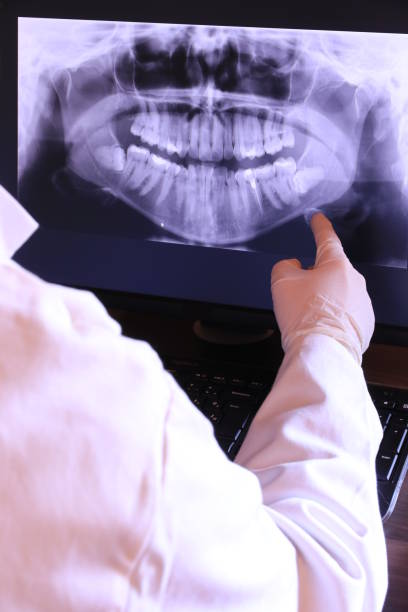 Best Teeth Whitening  in Wharton, TX