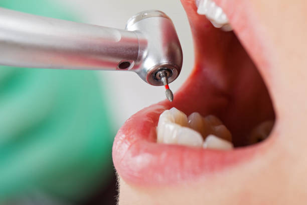 Best Tooth Infection Emergency Dentist  in Wharton, TX